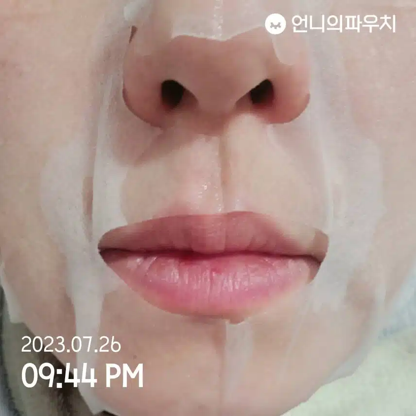 고생한 피부에게 열감내려주기
