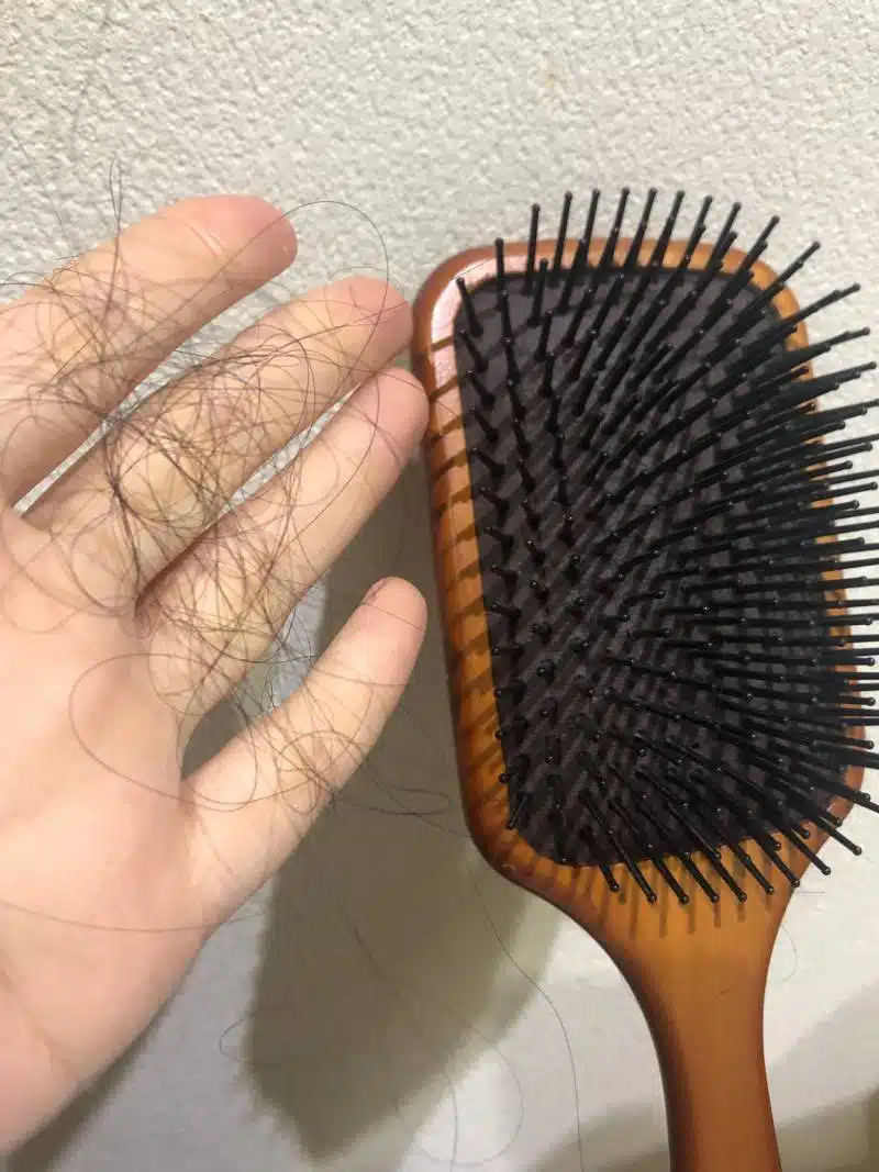 현재 탈모카페에서 제일 인기있는 샴푸