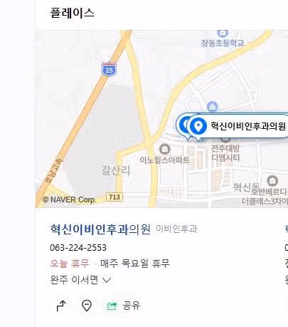 완주 이서면 혁신이비인후과 웨이팅하는 이유가 있지요