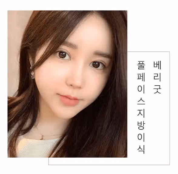 꺼진눈지방이식 해보려 합니다 :) 완전 궁금 상태