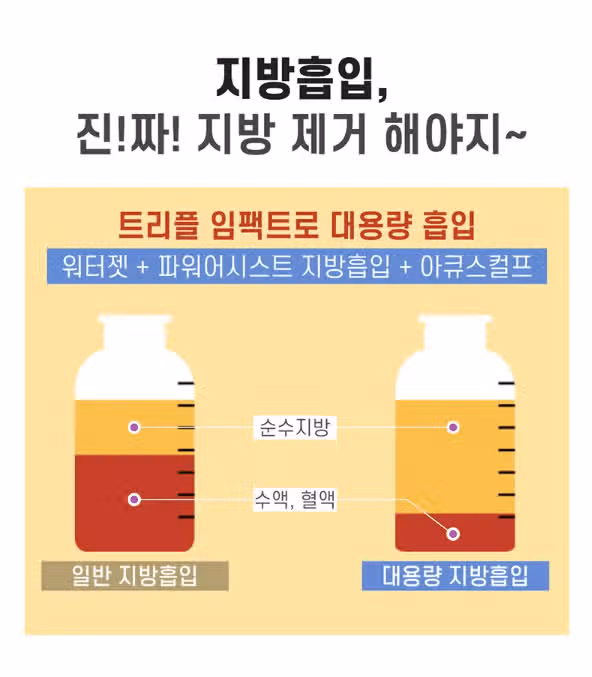 지방흡입수술 많이 아파요?? ㅠㅠ 걱정 태산 