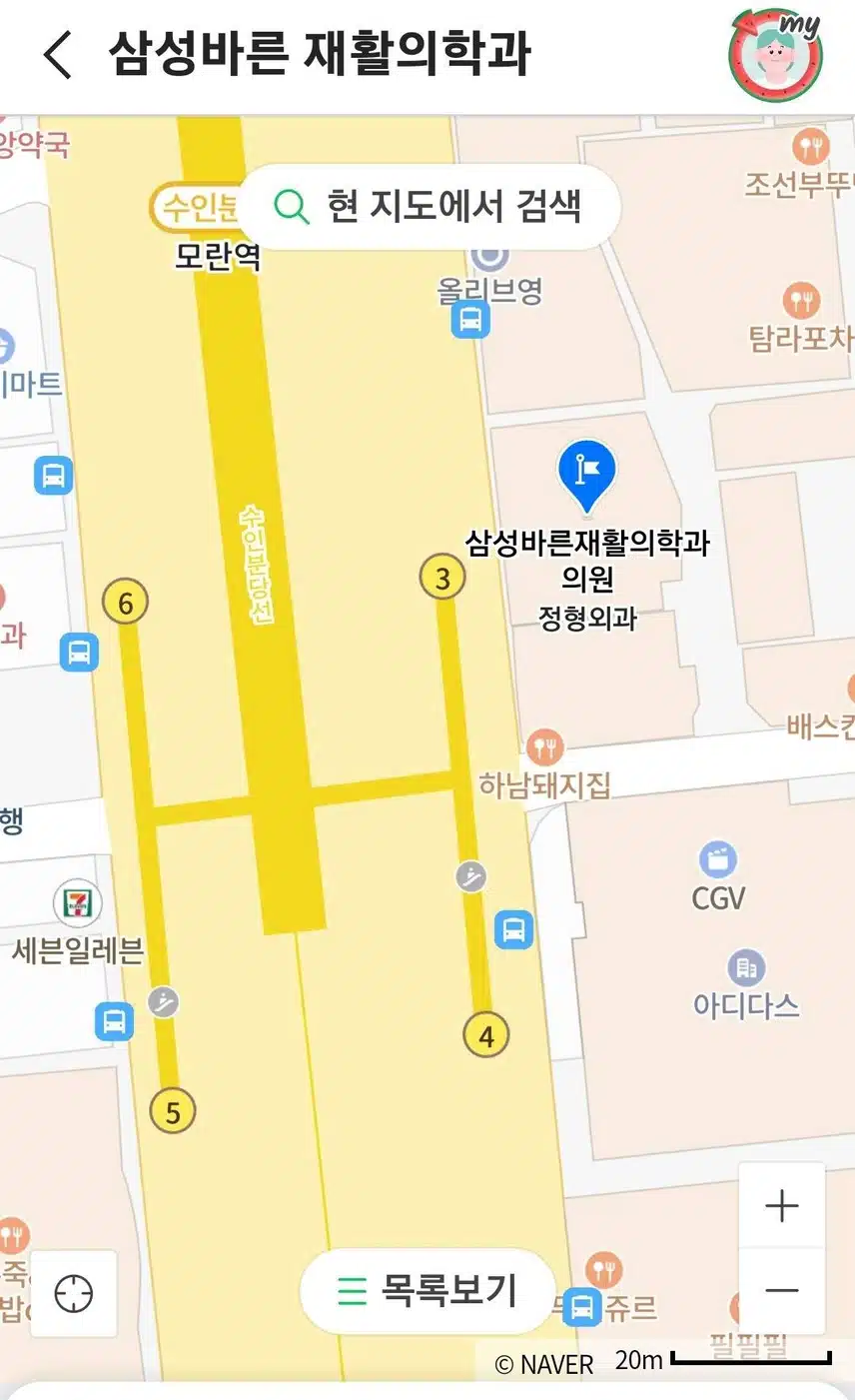 성남 바른재활의학과의원 추천해요