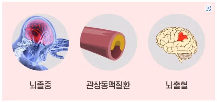 (꿀팁) 침묵의 살인자 !! 당신의 혈압은 안전한가요?? 