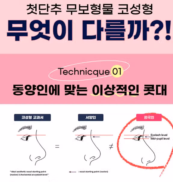 코성형붓기 심해요?? 붓기 빼는 법도 궁금합니다.