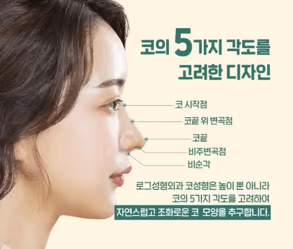 코성형붓기 심해요?? 붓기 빼는 법도 궁금합니다.