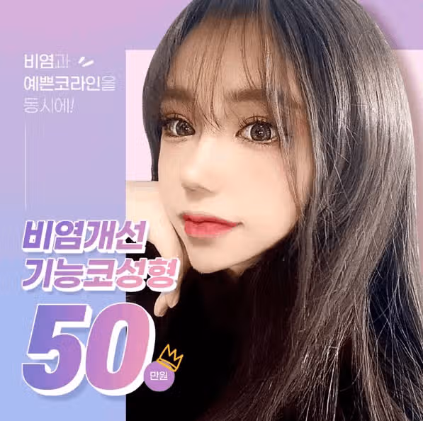 코성형술 후기입니다. (완전 좋았어요)