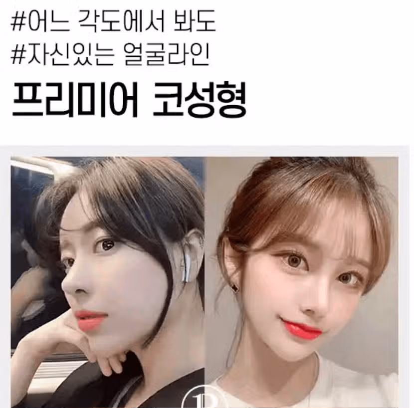 코수술 붓기 어느정도인가요? 해보고싶어요! 
