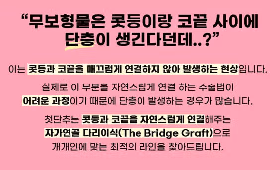 코끝수술로 이미지 변신?? 바로 해보세요 분위기 확 바뀜