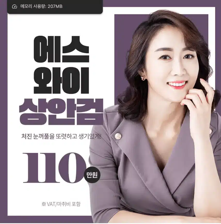 상안검수술후기 확인해보셔용 ~! 