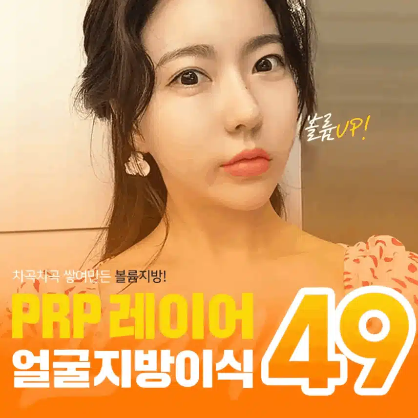 얼굴 지방이식 후기 알려드릴게용