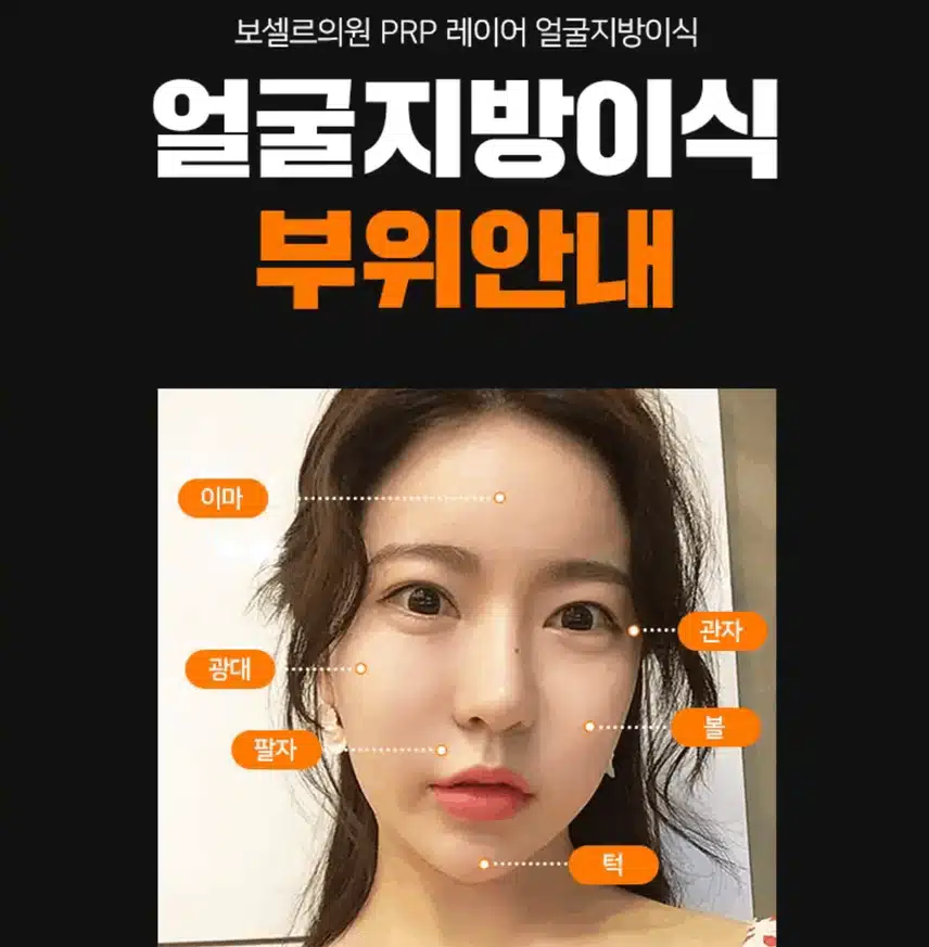 얼굴 지방이식 후기 알려드릴게용