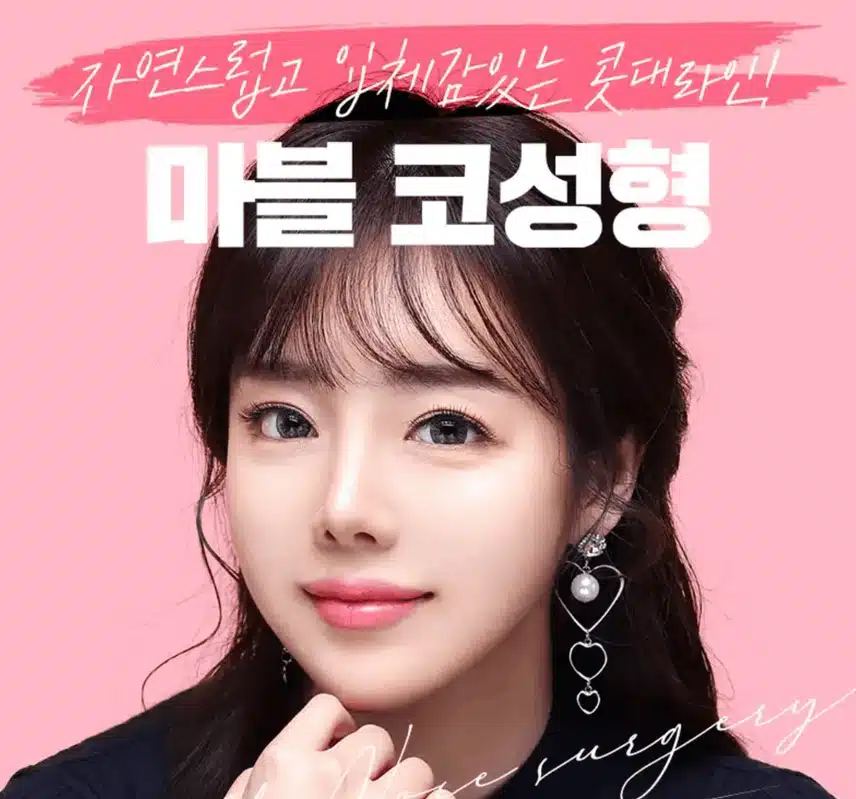 대구코성형 하시는 분들은 다들 어디서 하세요?  서울가야하나? 