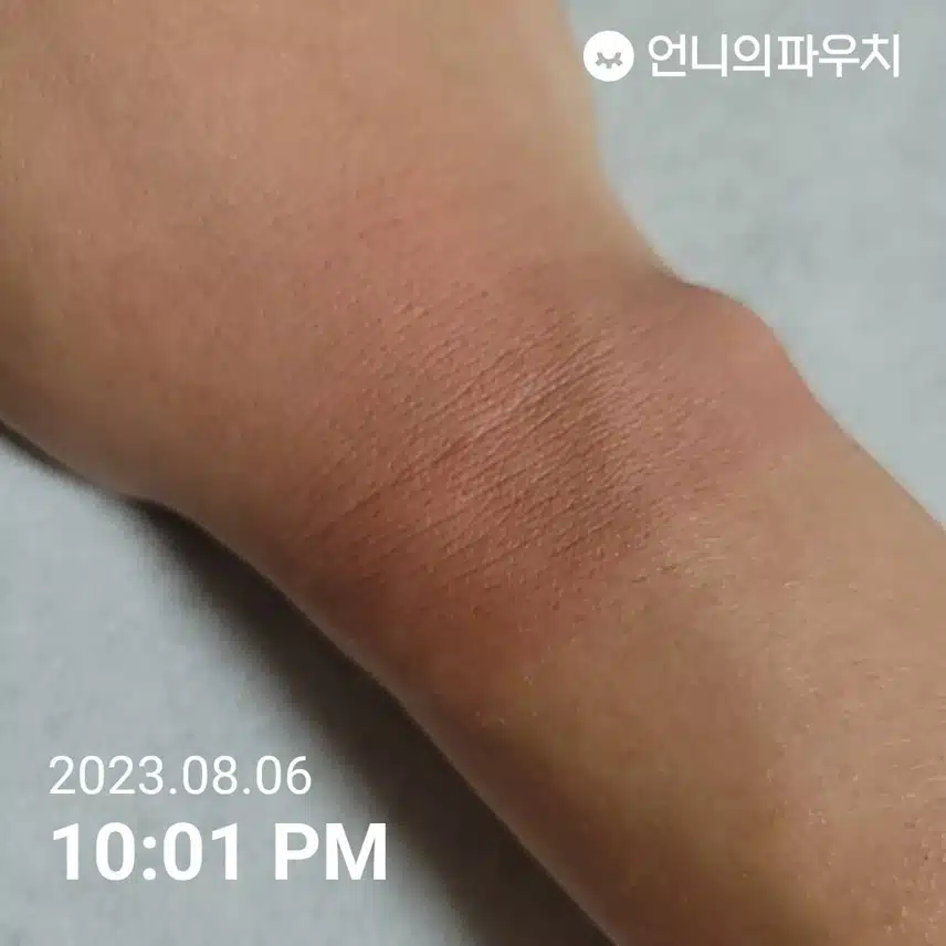 피부 햇빛에 탔을 때 어떤거 바르세요?