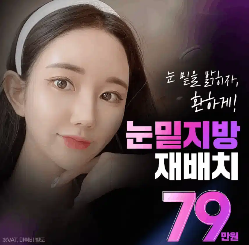 대구눈밑지방재배치 서울로,, 가야할까요? 
