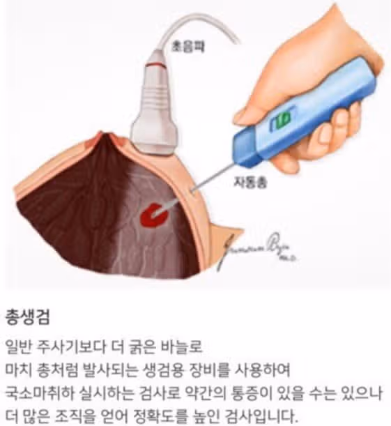 (후기) 건강검진의 중요성-누구나 암에 걸릴 수 있다.