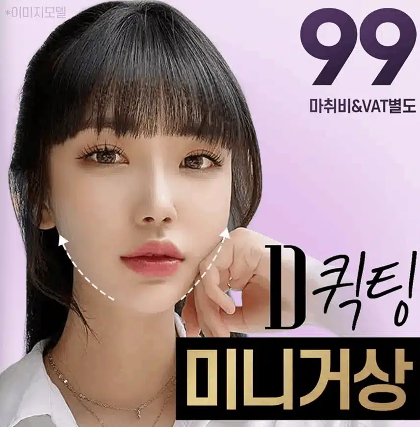 미니거상 후기 짧고 굵게 적어볼게요 :) 