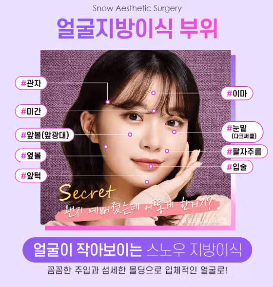 앞광대지방이식 할 수 있는 병원 알려주세요 ㅠ