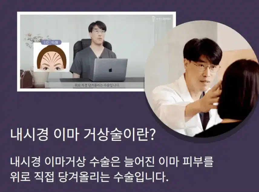 안면거상술로 나이들어 보이는 얼굴,, 바꾸기 성공!! 