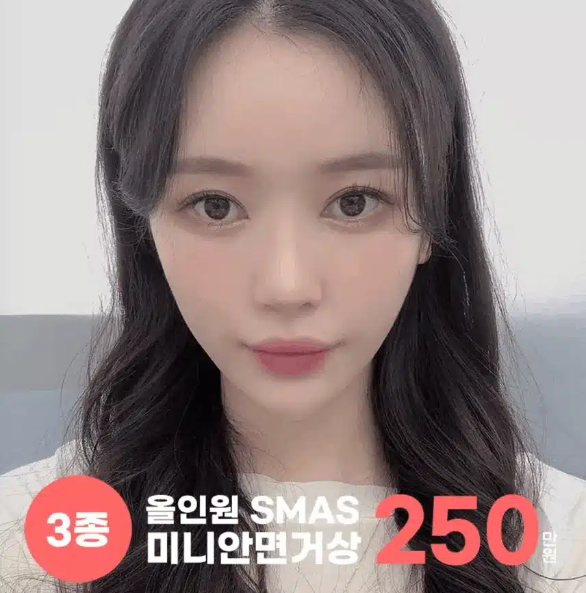 안면거상술 후기 적어봐요 :) 참고하세용 