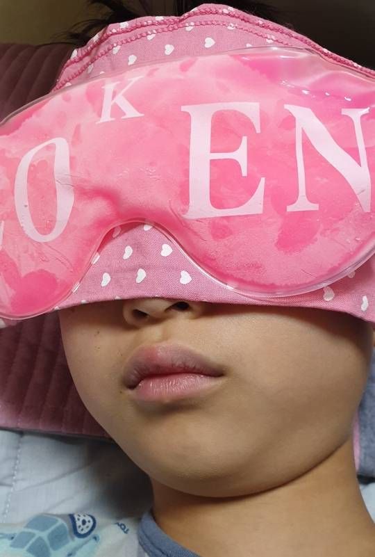 [후기]남아들은 학교에서 연락이 오면 무섭습니다 성형외과 상처 치료 후기에요