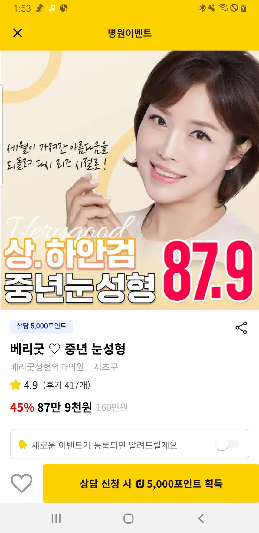 상하검 중년눈성형 시술 후기 추천해요
