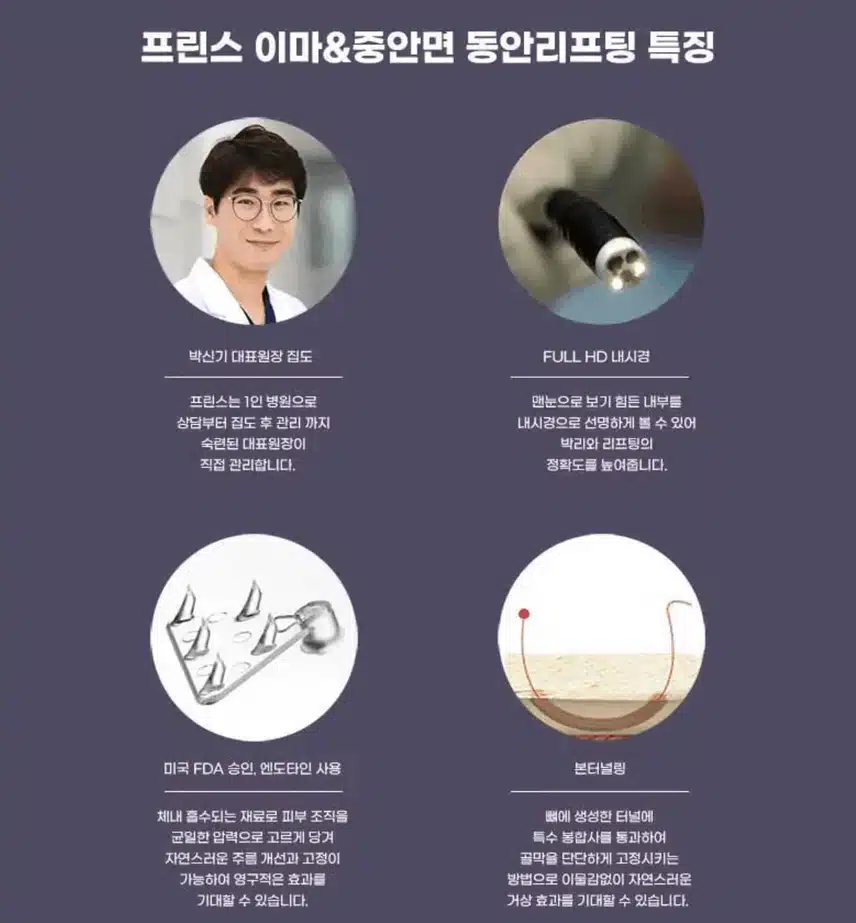 안면거상술효과 보고 추천드려용~~! 너무 좋아요 :) 