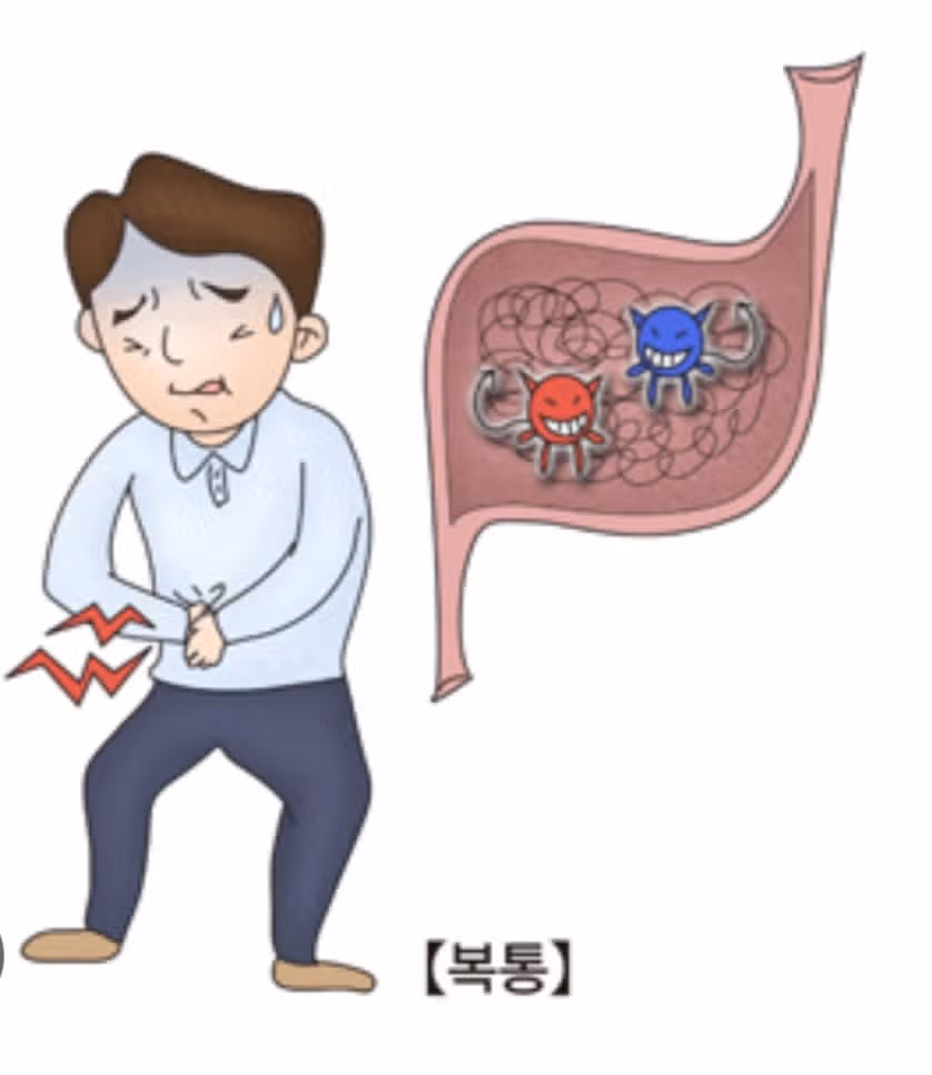 위경련 