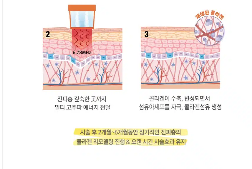 세종 올리지오 블리비의원...