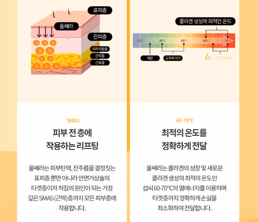 새종 잇츠미의원 울쎄라 맛집
