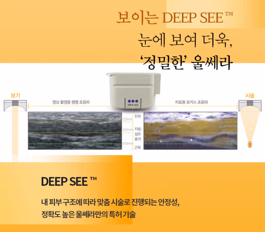 새종 잇츠미의원 울쎄라 맛집
