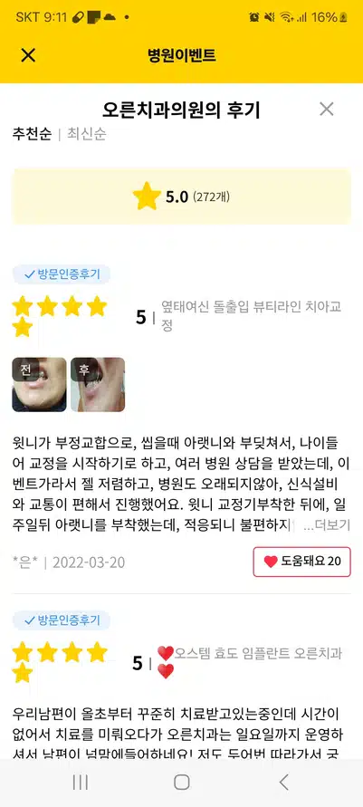 이전에 치료하고 안좋은 임플란트 재수술 상계동 오른치과에서 했어요