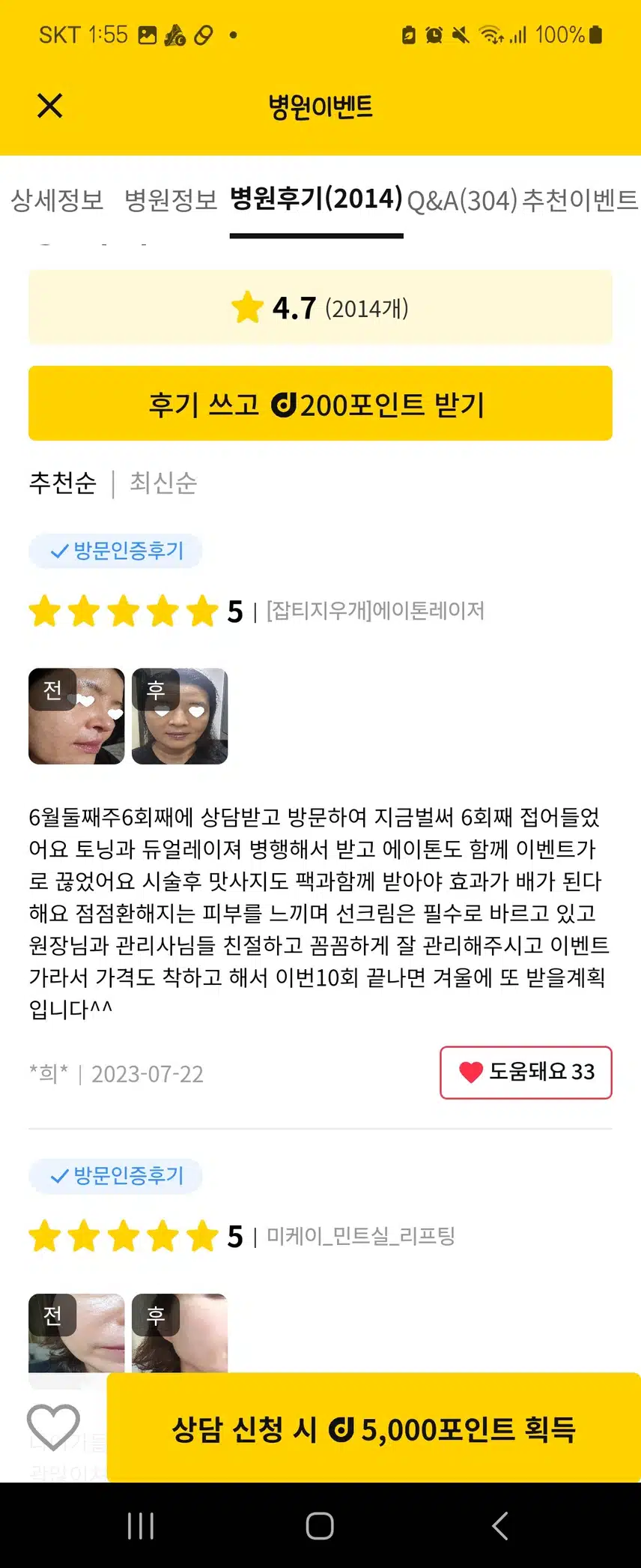 서초미케이의원 색소지우개 (에이톤레이져)후기추천해요