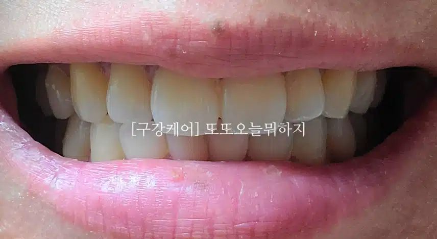 꼼꼼한 구강케어 되는 치실 소개해요!