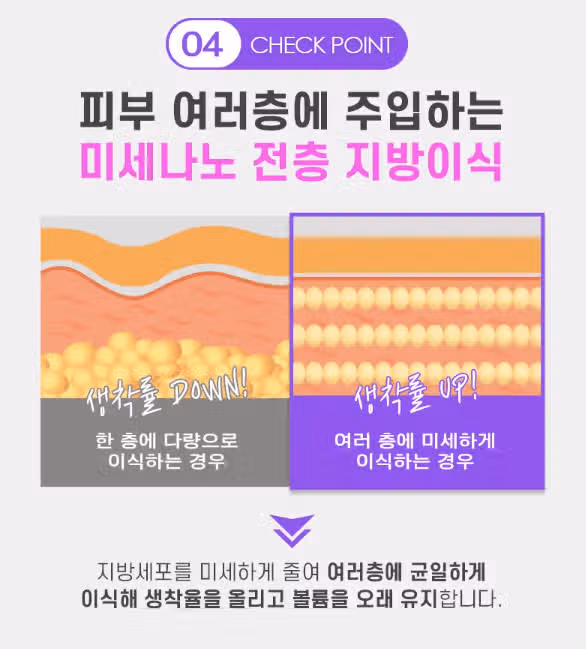 눈위지방이식 해보고 추천드립니당:) 