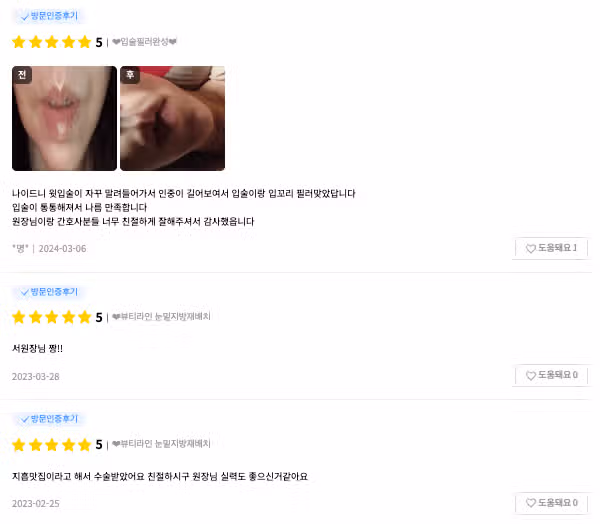 눈꺼짐지방이식 하면 효과 좋은편인가요? 