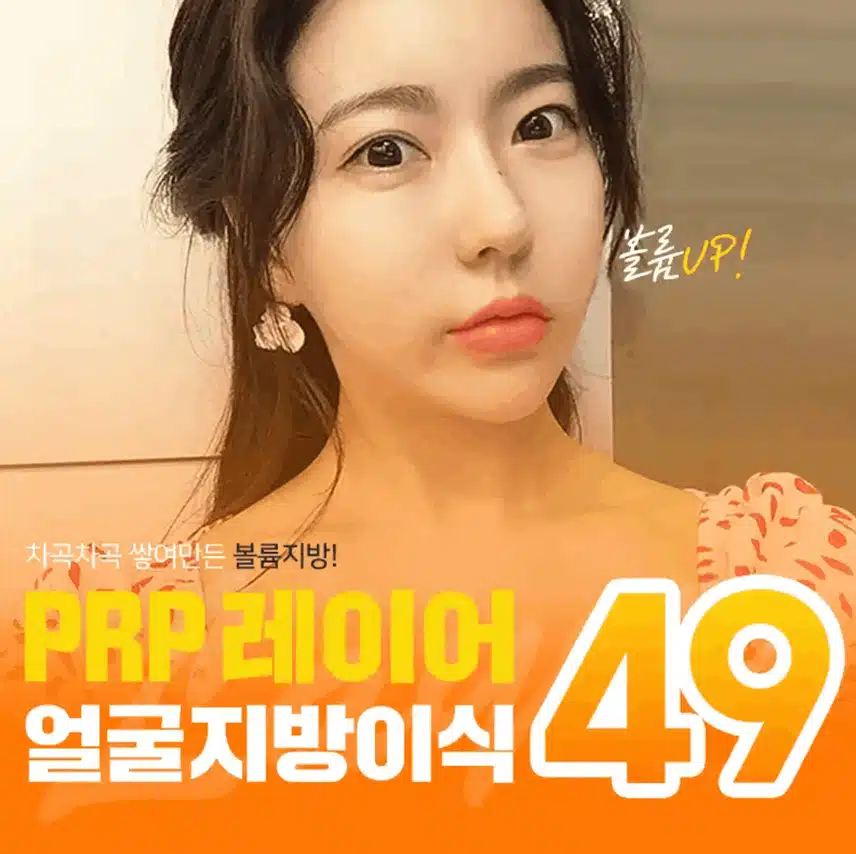 팔자주름 지방이식으로 가능한 거 아셨나요? 