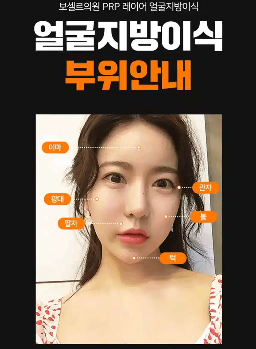 팔자주름 지방이식으로 가능한 거 아셨나요? 