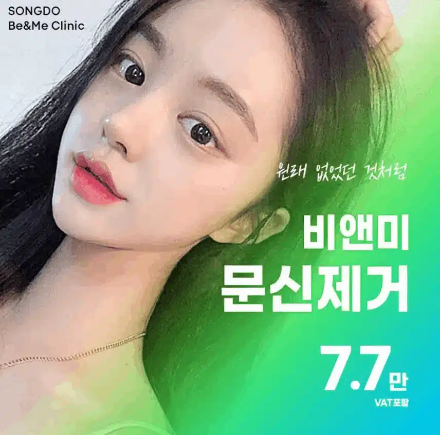 부천문신제거 ㅠㅠ 진짜 알아보고 어렵네요 아무데나 다 알려주세요 