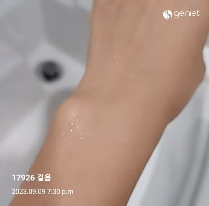  릴리 바이레드 팩트 (세범락)