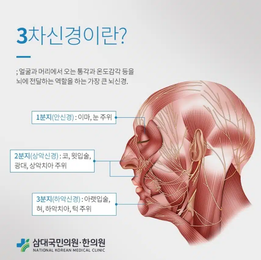 3차신경통을 아시나요?