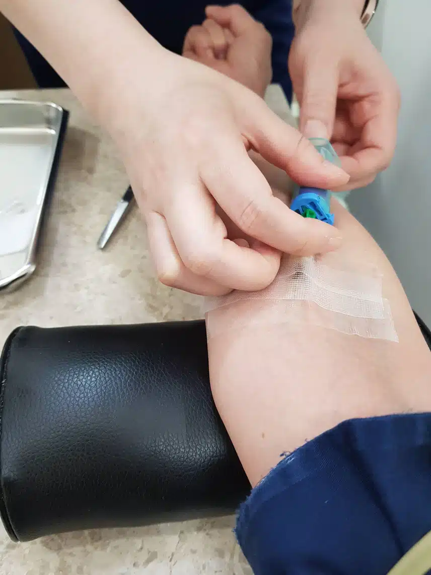 위 대장 내시경후 용종제거 했어요.