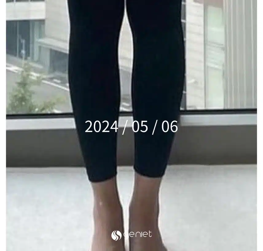 후기