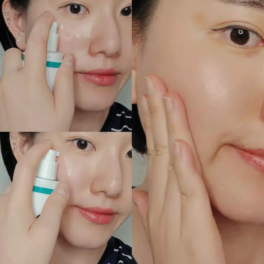 여드름 피부에 사용하기 좋은 토너