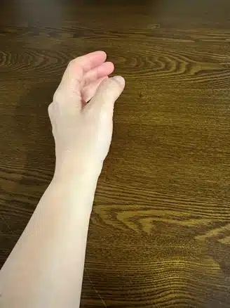 장기간 컴퓨터 사용으로 생긴 손목 통증 앵커 버티컬 마우스 사용으로 통증이 사라졌어요.