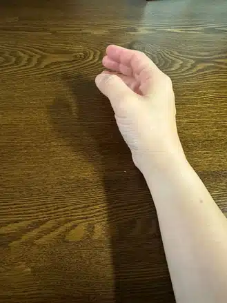 장기간 컴퓨터 사용으로 생긴 손목 통증 앵커 버티컬 마우스 사용으로 통증이 사라졌어요.
