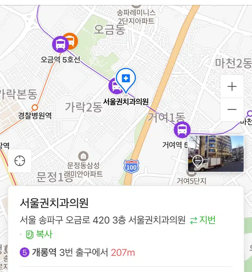 송파구 서울권치과 추천해요