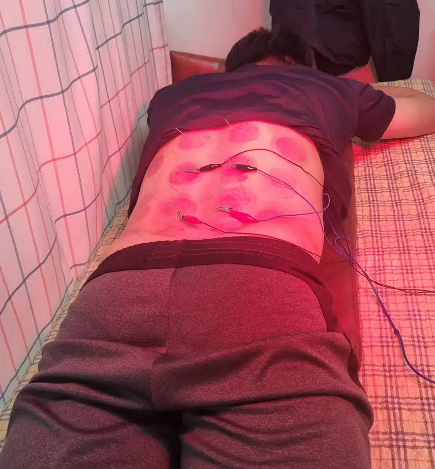 [한방병원후기]근육이 놀랬다는데 허리가 으르신이 되셨네요