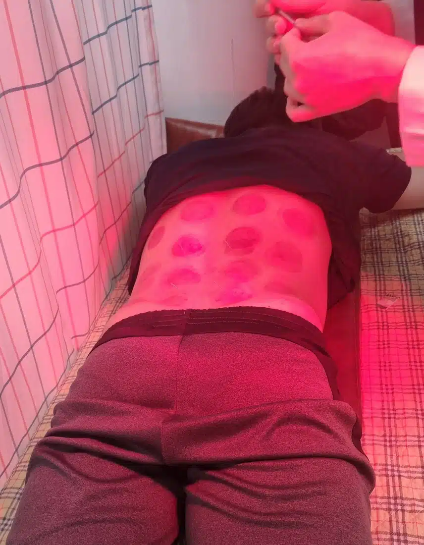 [한방병원후기]근육이 놀랬다는데 허리가 으르신이 되셨네요