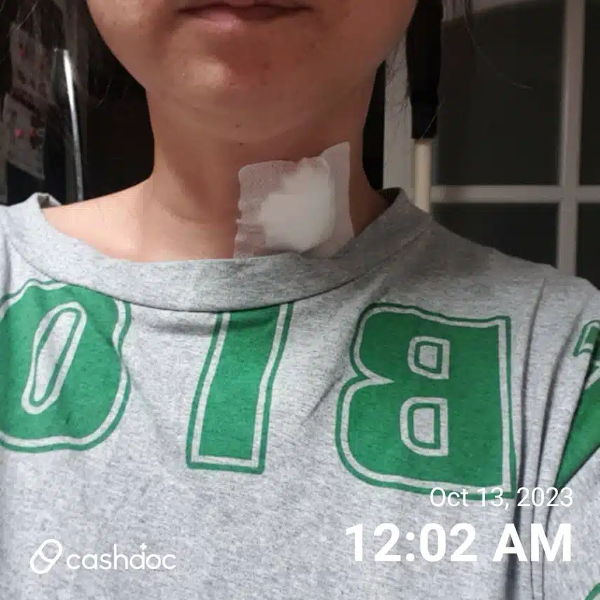 결국 조직검사까지...ㅠㅠ