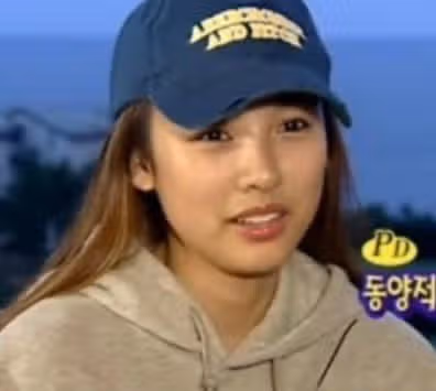 [질문] 잇몸성형 언제가 좋을까요?
